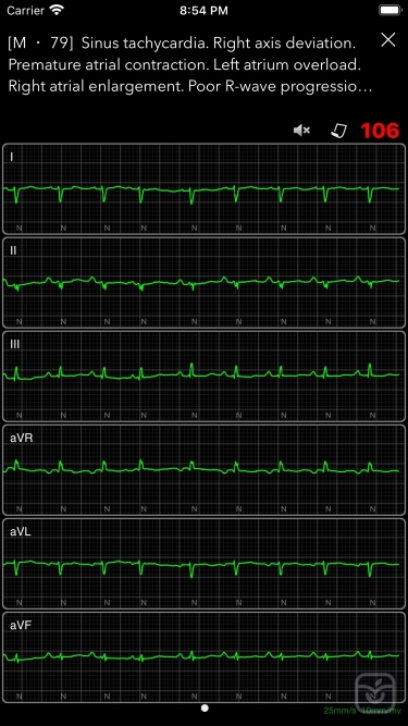 تصاویر ECG Books Pro