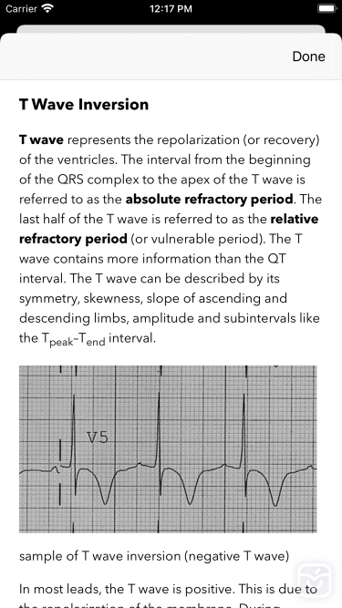 تصاویر ECG Test Pro