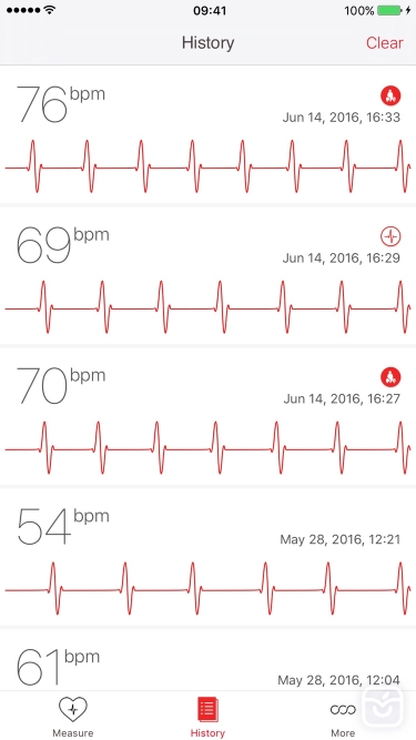 تصاویر Cardiograph