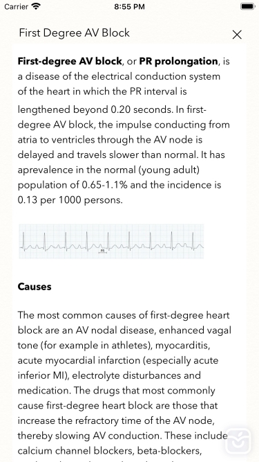 تصاویر ECG Books Pro