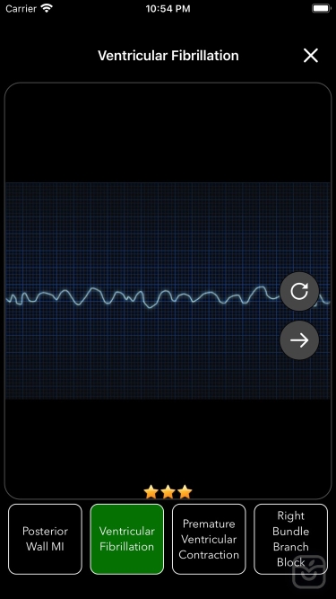 تصاویر ECG Test Pro