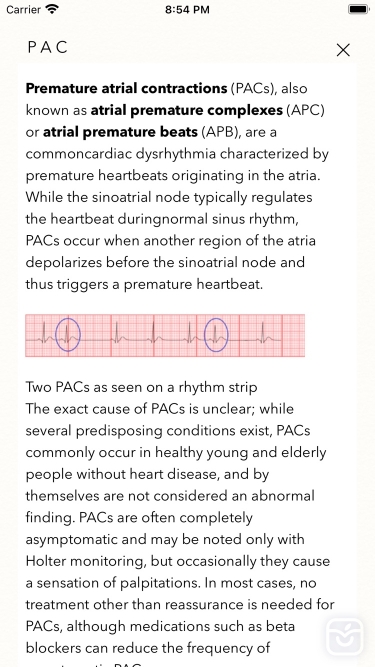 تصاویر ECG Books Pro