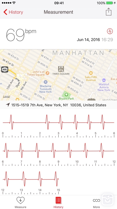 تصاویر Cardiograph