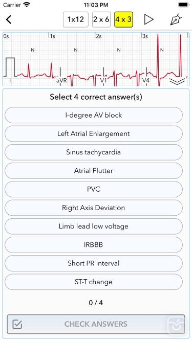 تصاویر ECG Test Pro