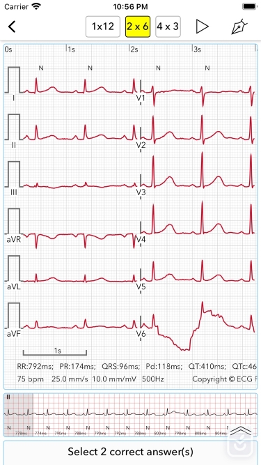 تصاویر ECG Test Pro