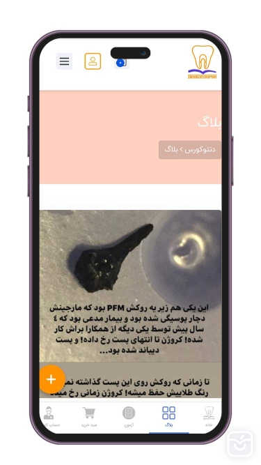 تصاویر دنتوکورس