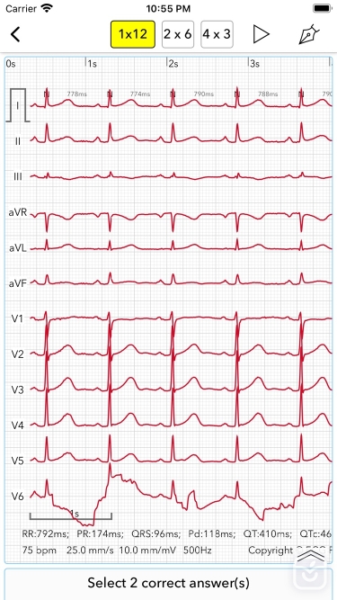تصاویر ECG Test Pro