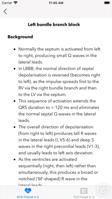 تصاویر ECG A-Z Pro