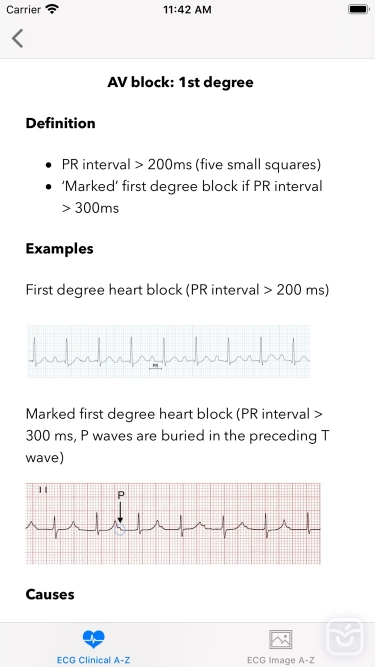 تصاویر ECG A-Z Pro
