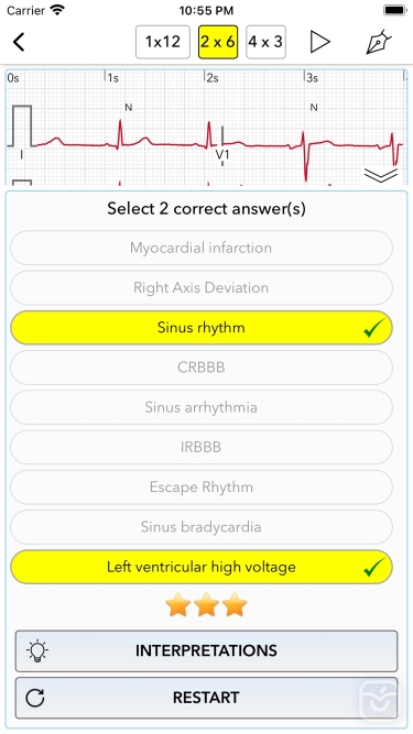 تصاویر ECG Test Pro