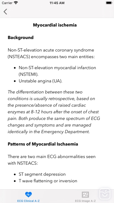 تصاویر ECG A-Z Pro