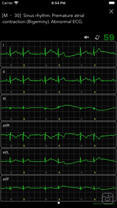 تصاویر ECG Books Pro