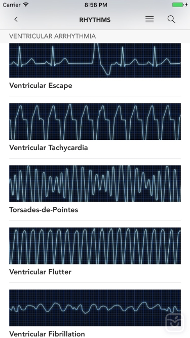 تصاویر Instant ECG - Mastery of EKG