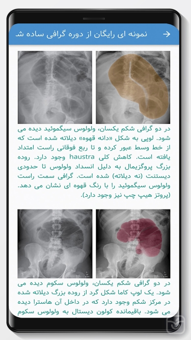 تصاویر نسخه نویسی سیب