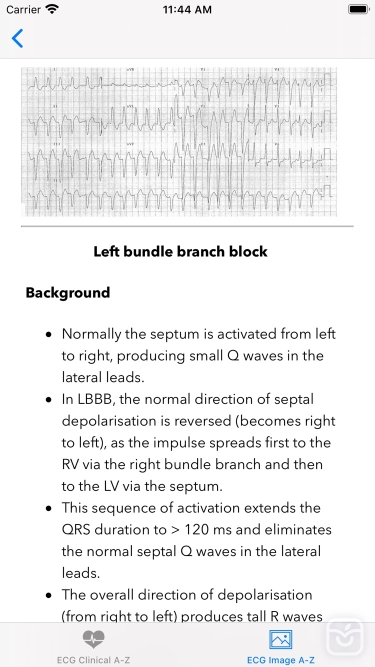 تصاویر ECG A-Z Pro