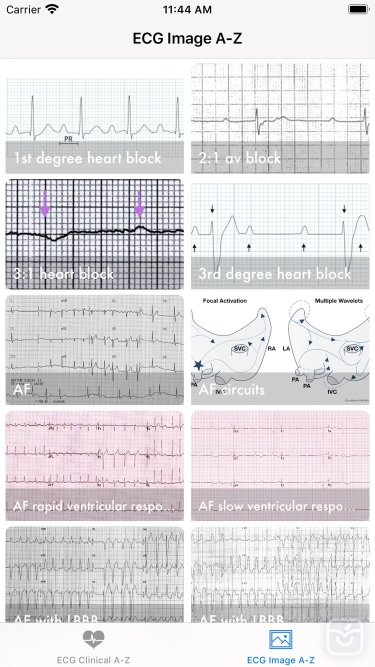 تصاویر ECG A-Z Pro
