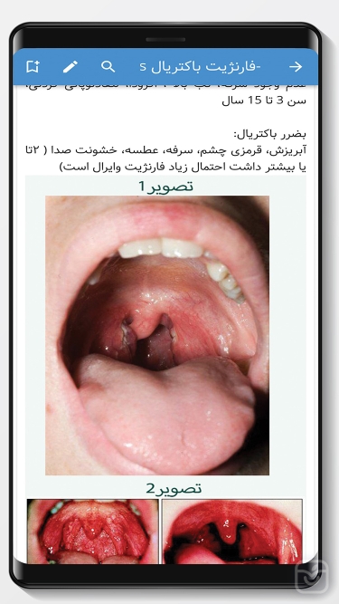 تصاویر نسخه نویسی سیب