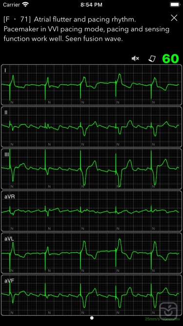 تصاویر ECG Books Pro